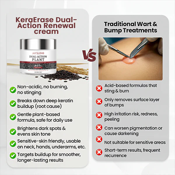 ✅⏰Hot Sale 50% OFF🎁-Flash Sale - KeraErase Dual-Action Renewal Cream