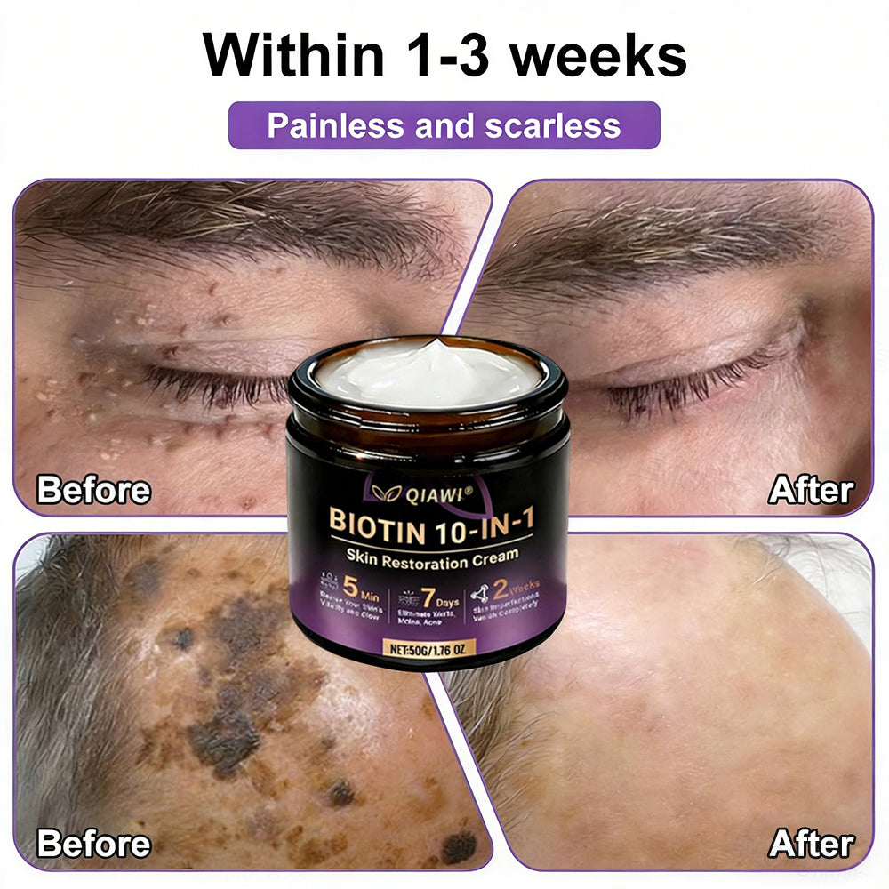 🔥LAST DAY 50% OFF - QIAWI® Biotin 10-in-1 Skin Restoration Cream-INT