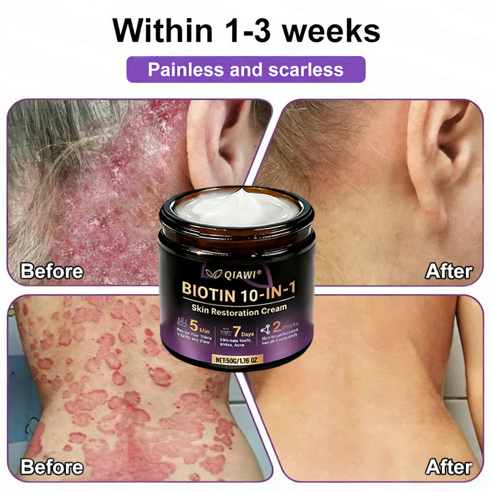 🔥LAST DAY 50% OFF - QIAWI® Biotin 10-in-1 Skin Restoration Cream-INT