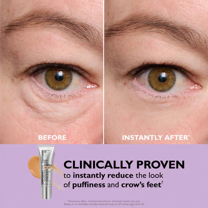 ⚡️First 100:2nd Item 60%Off🔥Easy Wear Temporary Eye Tightener-W18