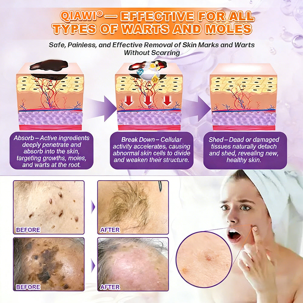 🔥LAST DAY 50% OFF - QIAWI® Biotin 10-in-1 Skin Restoration Cream-INT