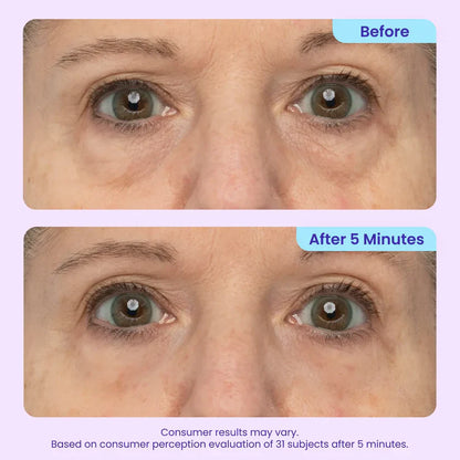 Final 3 Hours: 60%OFF🔥 Instant Lift Eye Gel for Puffiness, Bags & Dark Circles-H1