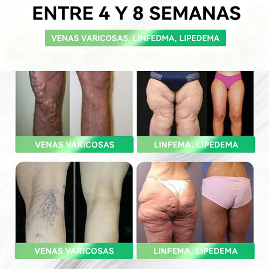 𝐕𝐞𝐫𝐯𝐞𝐛𝐞𝐚𝐝® 𝑮𝑳𝑷-𝟏 𝟖 𝒆𝒏 𝟏 𝑭𝒊𝒕 & 𝑽𝒊𝒕𝒂𝒍 (𝒔𝒐𝒍𝒐 𝒖𝒏𝒂 𝒗𝒆𝒛 𝒂𝒍 𝒅𝒊́𝒂, 𝒄𝒂𝒎𝒃𝒊𝒐𝒔 𝒗𝒊𝒔𝒊𝒃𝒍𝒆𝒔 𝒆𝒏 𝟕 𝒅𝒊́𝒂𝒔) √ 𝑷𝒂𝒓𝒂 𝒐𝒃𝒆𝒔𝒊𝒅𝒂𝒅, 𝒔𝒂𝒍𝒖𝒅 𝒄𝒂𝒓𝒅𝒊𝒐𝒗𝒂𝒔𝒄𝒖𝒍𝒂𝒓, 𝒅𝒊𝒂𝒃𝒆𝒕𝒆𝒔, 𝒂𝒑𝒏𝒆𝒂 𝒅𝒆𝒍 𝒔𝒖𝒆𝒏̃𝒐, 𝒔𝒂𝒍𝒖𝒅 𝒊𝒏𝒕𝒆𝒔𝒕𝒊𝒏𝒂𝒍, 𝒑𝒓𝒐𝒃𝒍𝒆𝒎𝒂𝒔 𝒂𝒓𝒕𝒊𝒄𝒖𝒍𝒂𝒓𝒆𝒔 𝒚 𝒎𝒂́𝒔-ZZQ xy