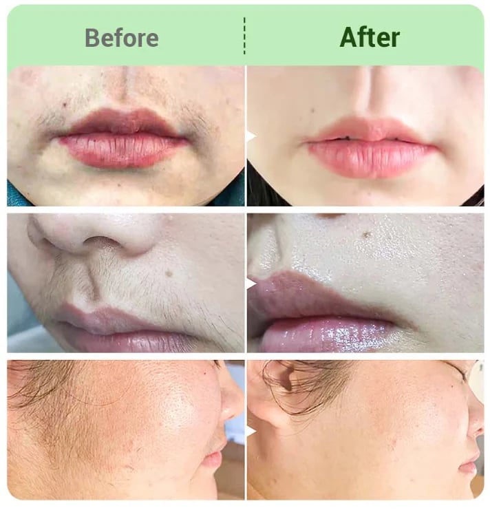 Vervebead™ Hair Removal Cream for All Women & Men-Discounted Repeat Purchase-923