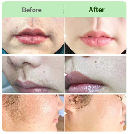 TAILEDEN™ Hair Removal Cream for All Women & Men-INT