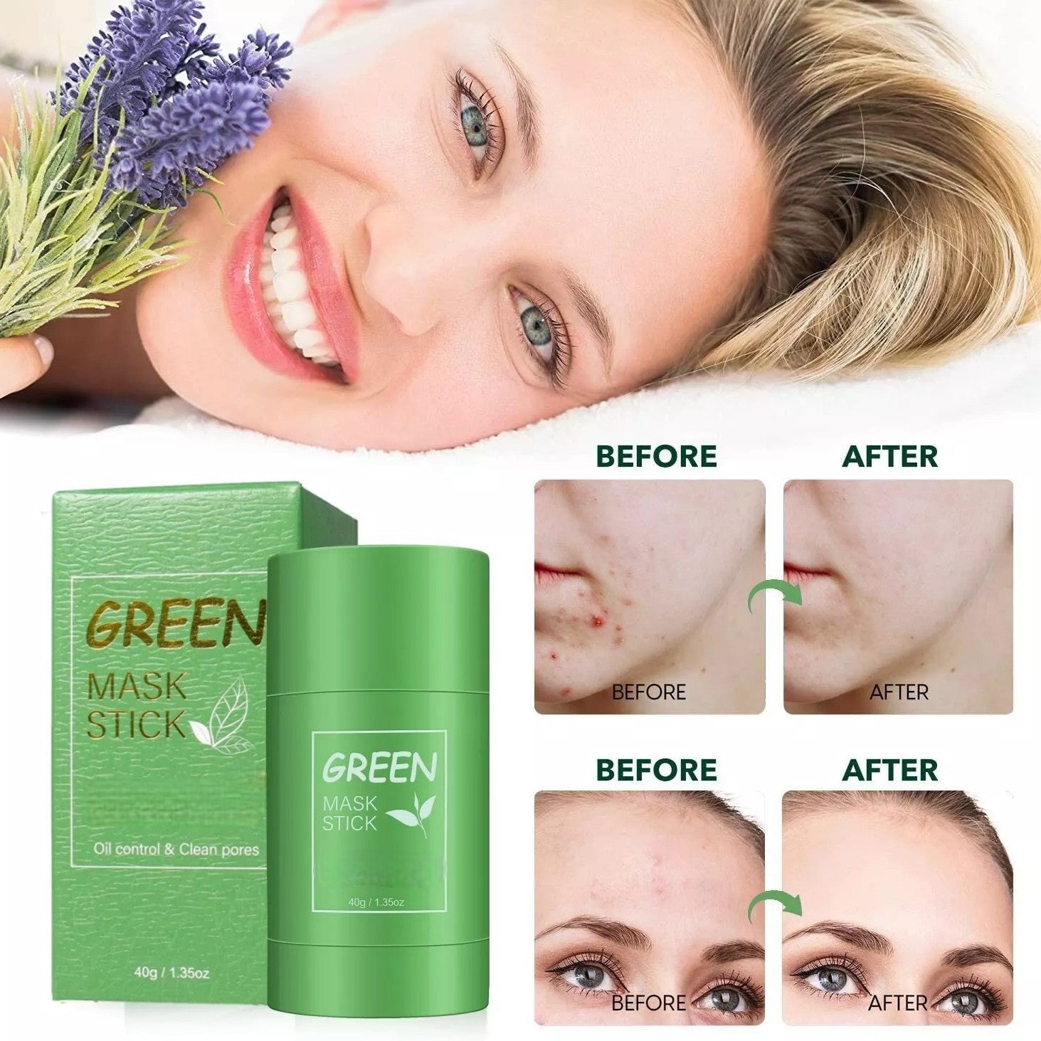 Green mask stick with packaging and before-and-after effects on skin