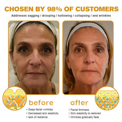🔥First 100:2nd Item 60%Off🔥Botox Bee Venom-W18