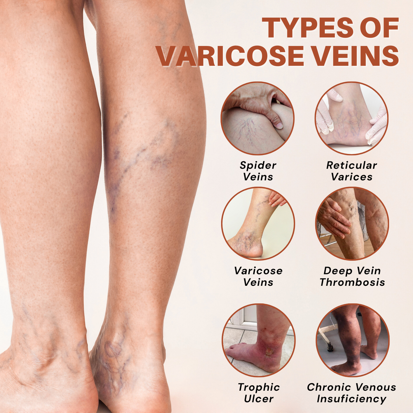 Vein Target Microneedle Patch- Instant Relief, Long-Term Results-H1
