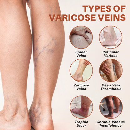 Vein Target Microneedle Patch- Instant Relief, Long-Term Results-H1