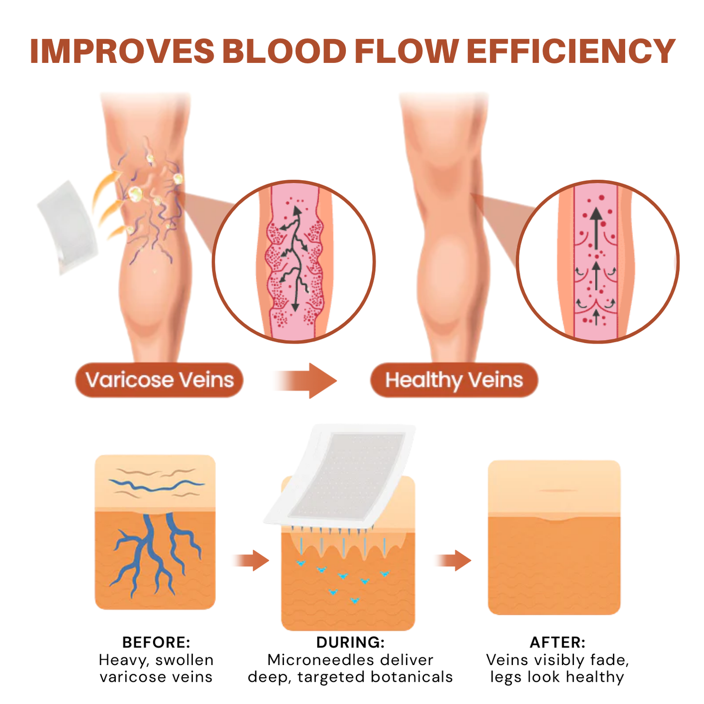 Vein Target Microneedle Patch- Instant Relief, Long-Term Results-H1