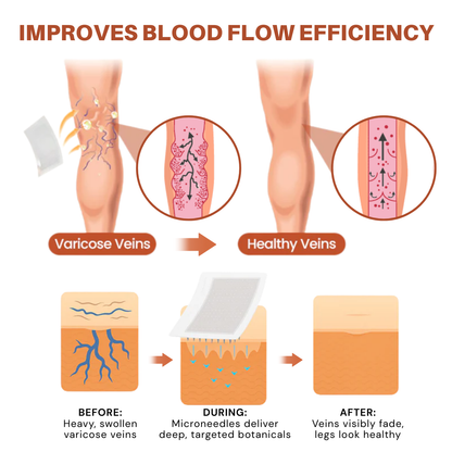 Vein Target Microneedle Patch- Instant Relief, Long-Term Results-H1