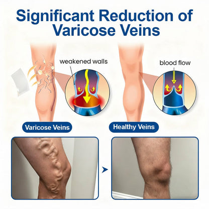 VERVEBEAD™🧑‍⚕️ Vein Ease Microneedle Patch -Visible Vein Reduction in 7 Days, No Clinic, No Compression Socks, Just sleep-ABB8