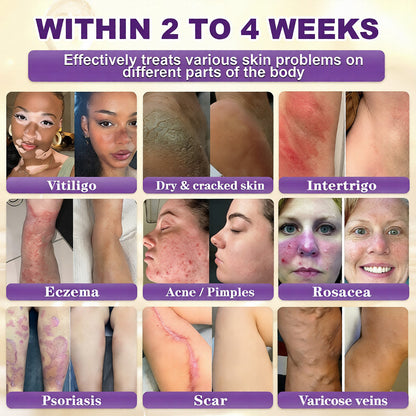 🔥LAST DAY 50% OFF - QIAWI® Biotin 10-in-1 Skin Restoration Cream-INT