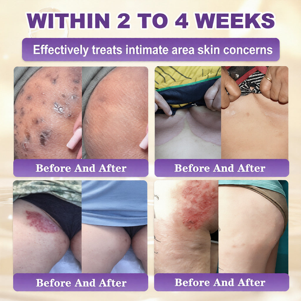 Made and Shipped from USA ✨QIAWI® Biotin 10-in-1 Skin Restoration Cream 🍀-H1