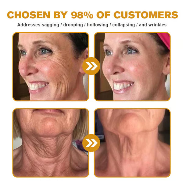 🔥First 100:2nd Item 60%Off🔥Botox Bee Venom-W18