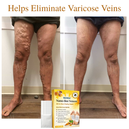 🚨 Stocks Are Running Low.| RZXEA™ Nano-Bee Venom All-in-One Vitality Patch-GD