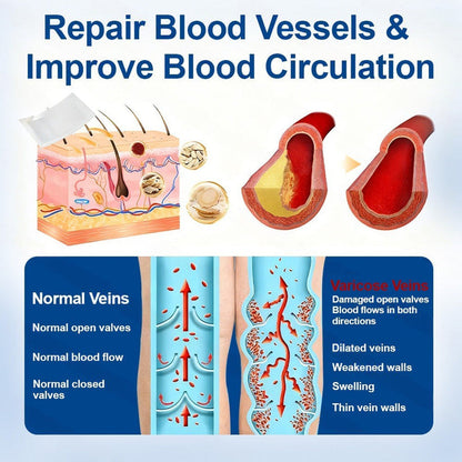 VERVEBEAD™🧑‍⚕️ Vein Ease Microneedle Patch -Visible Vein Reduction in 7 Days, No Clinic, No Compression Socks, Just sleep-ABB8