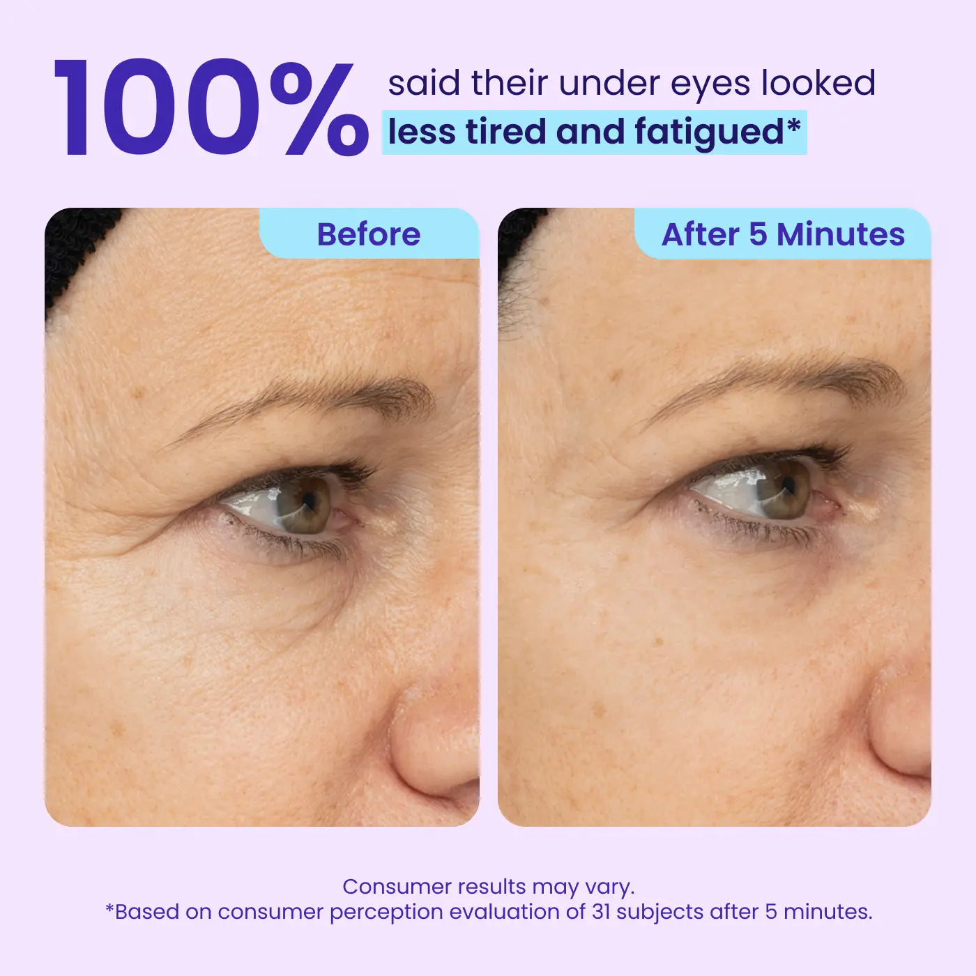 Final 3 Hours: 60%OFF🔥 Instant Lift Eye Gel for Puffiness, Bags & Dark Circles-C-XA