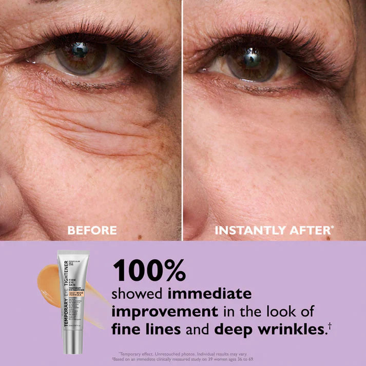 ⚡️First 100:2nd Item 60%Off🔥Easy Wear Temporary Eye Tightener-W18
