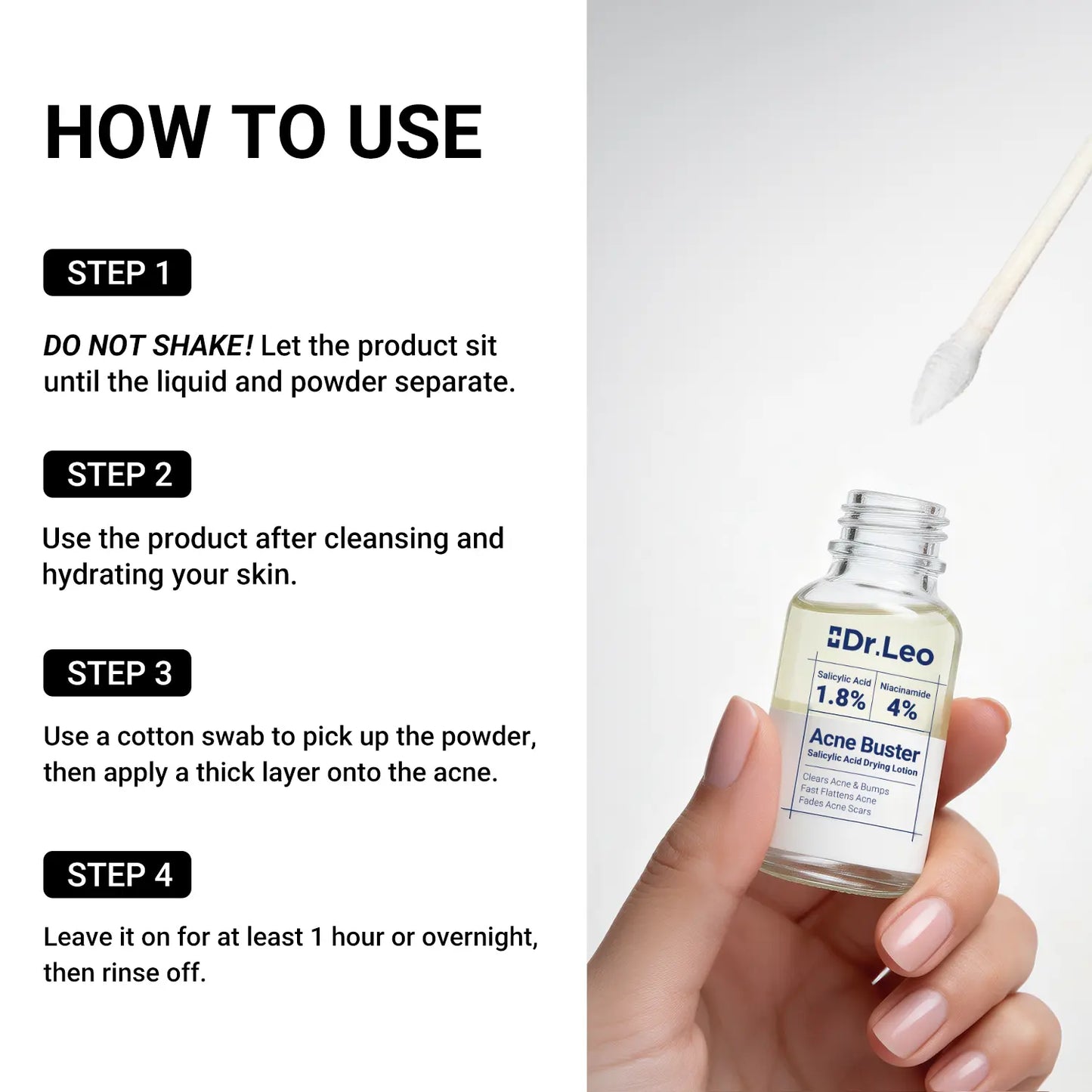 Drying Lotion Plus | Acne & Pimple Treatment | Visibly Shrinks Pimples in 24 Hours & Helps Fade Acne Marks in 7 Days - A926
