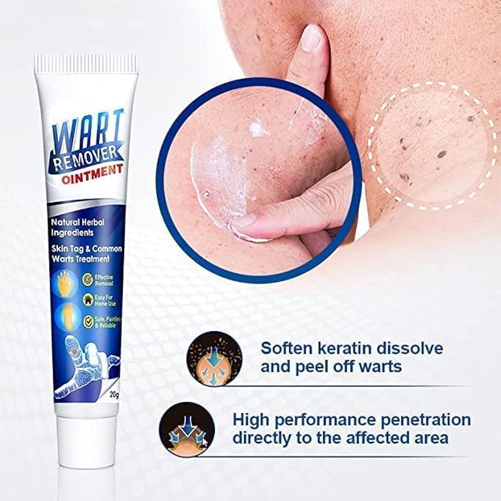 Wart Remover cream-H1