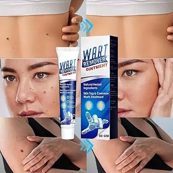 Wart Remover cream-H1