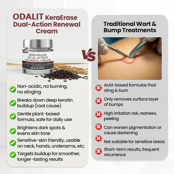 Flash Sale - ODALIT®KeraErase Dual-Action Renewal Cream-GD