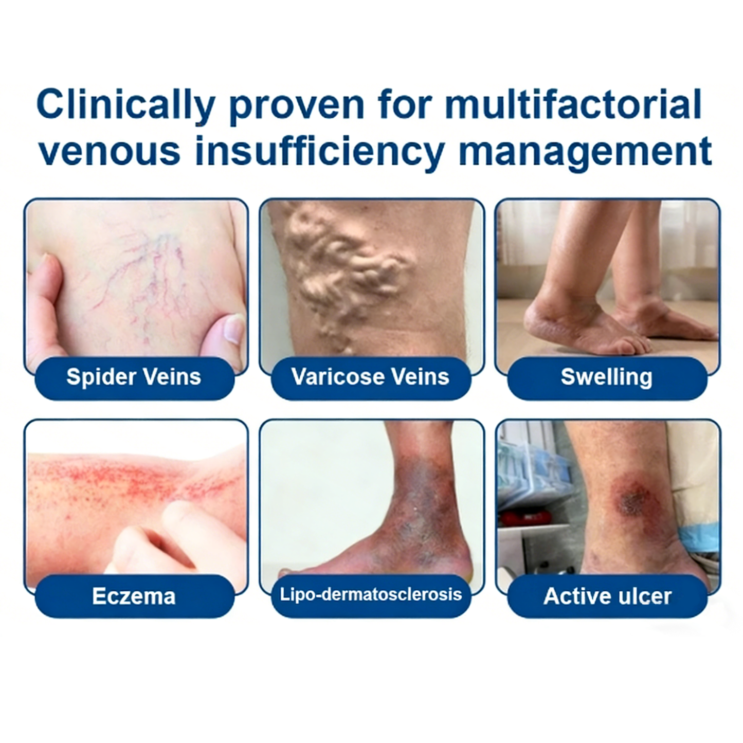 Vervebead™Vein ContourMicroneedle Patch with AdvancedDiosmin & Hesperidin Delivery 🌿 7-Day Visible Results for VaricoseVeins-923