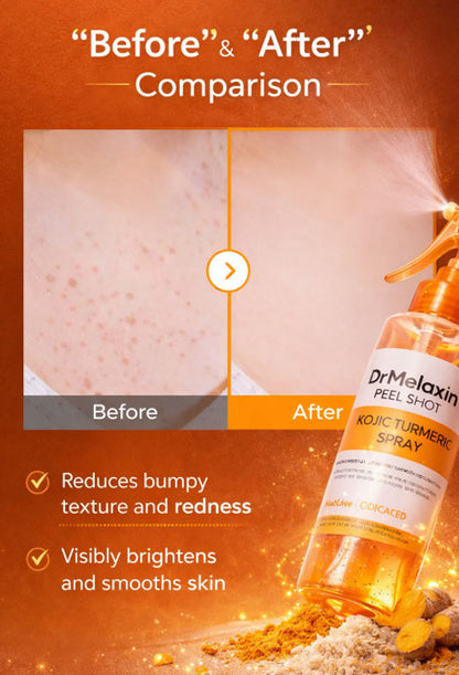 👑Hot Sale 49% OFF🏆Peel Shot Keratin Care Kojic Acid Turmeric Spray 200ml Pore Clearing Exfoliating Formula Skin Repair Scrub-TJY