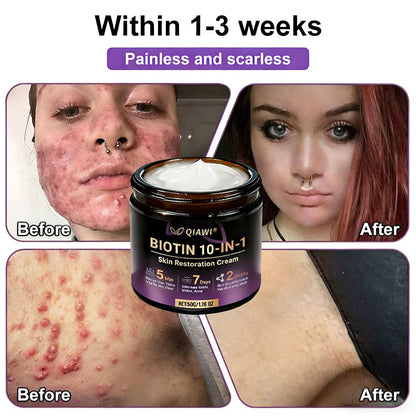 Made and Shipped from USA ✨QIAWI® Biotin 10-in-1 Skin Restoration Cream 🍀-H1
