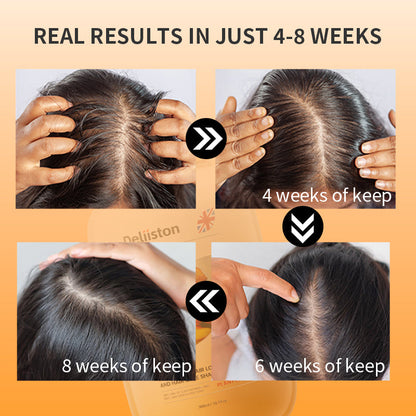 Deliiston Anti-Hair Loss Shampoo