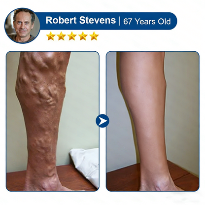 Vervebead™Vein ContourMicroneedle Patch with AdvancedDiosmin & Hesperidin Delivery 🌿 7-Day Visible Results for VaricoseVeins-923