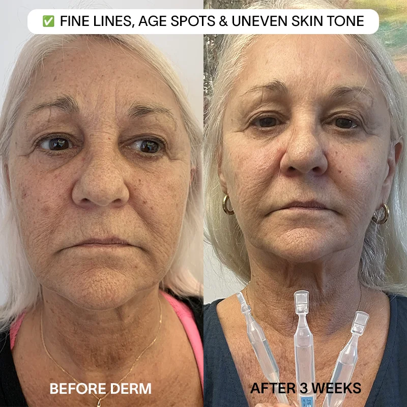 🎉🎁Buy 2 Get 1 Free - 3% Hyaluronic Acid Glass Skin Serum - A926