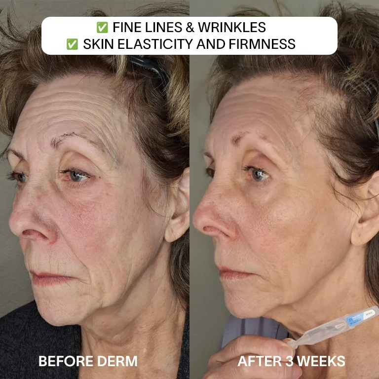 🎉🎁Buy 2 Get 1 Free - 3% Hyaluronic Acid Glass Skin Serum - A926