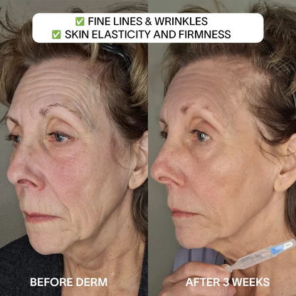 🎉🎁Buy 2 Get 1 Free - 3% Hyaluronic Acid Glass Skin Serum - A926