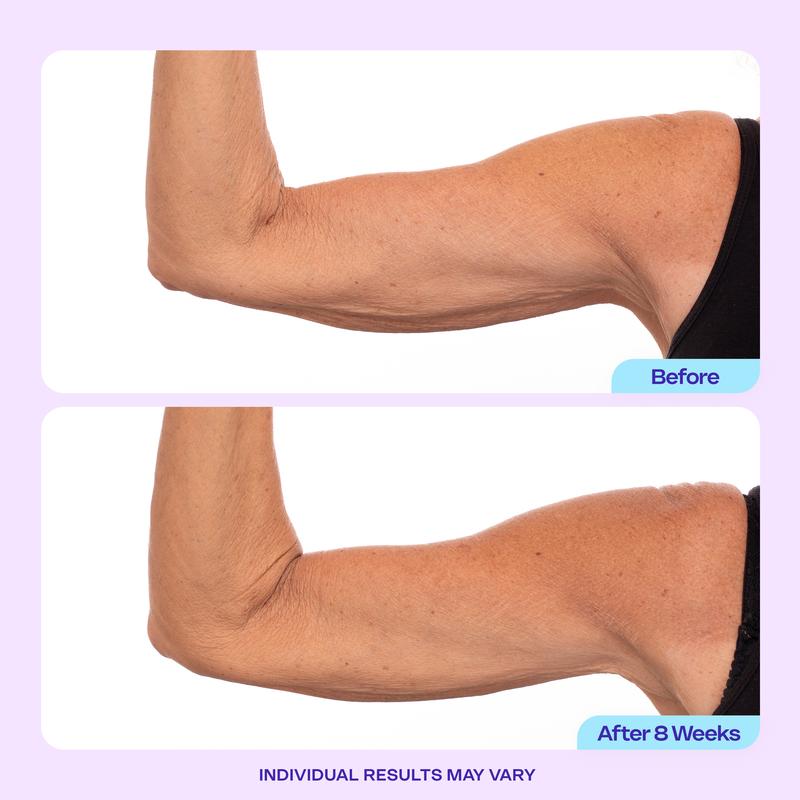 🏆Flash Sale⚡ 120K+ SOLD! 🏆Sculpt & Tone Arm Cream-W18