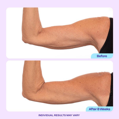 🏆Flash Sale⚡ 120K+ SOLD! 🏆Sculpt & Tone Arm Cream-W18