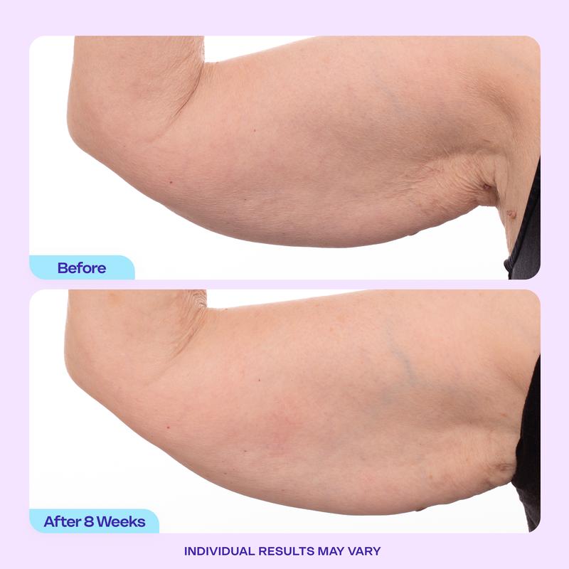 🏆Flash Sale⚡ 120K+ SOLD! 🏆Sculpt & Tone Arm Cream-W18