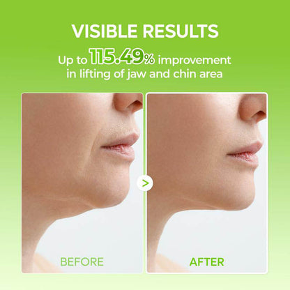 🏆Flash Sale⚡ Newly Upgraded！🏆Bikini Trimmer for Women-W18