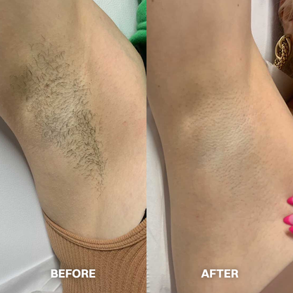 💯Hair Removal Cream for All Women & Men💯-923