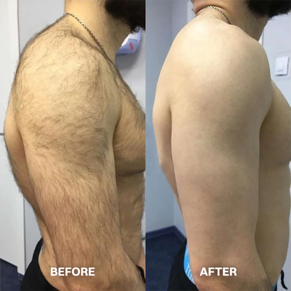 💯Hair Removal Cream for All Women & Men💯-923