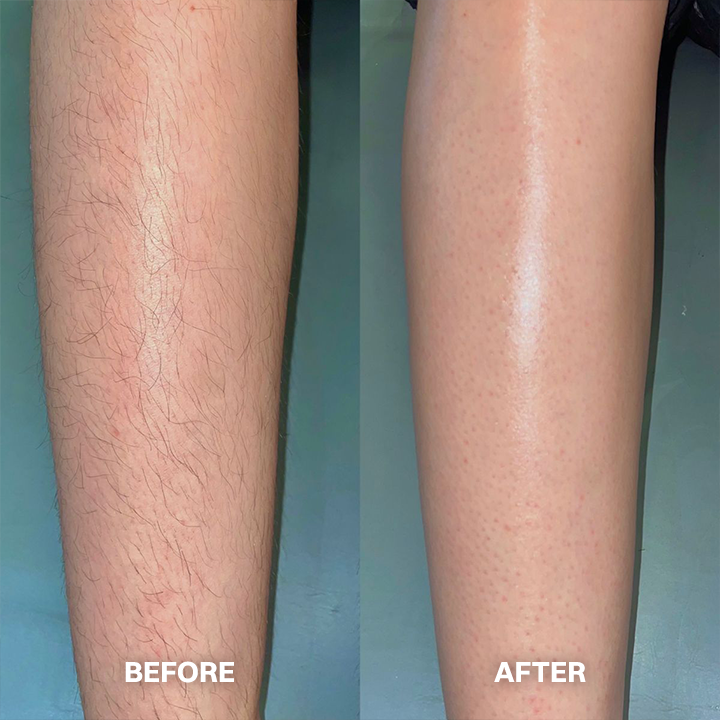 💯Hair Removal Cream for All Women & Men💯-923