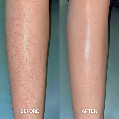 💯Hair Removal Cream for All Women & Men💯-923