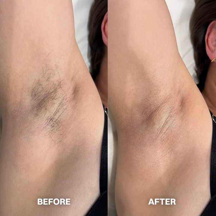 💯Hair Removal Cream for All Women & Men💯-923