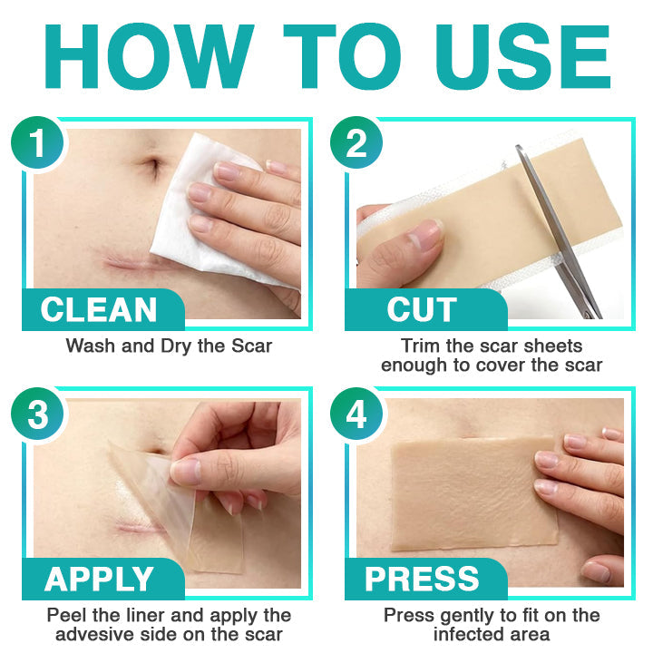 VERVEBEAD™ 3-in-1 Silicone Scar Sheets - A926