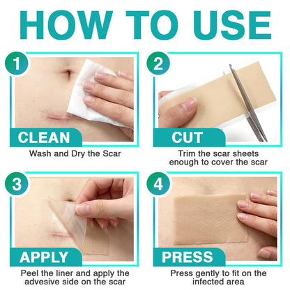 VERVEBEAD™ 3-in-1 Silicone Scar Sheets - A926