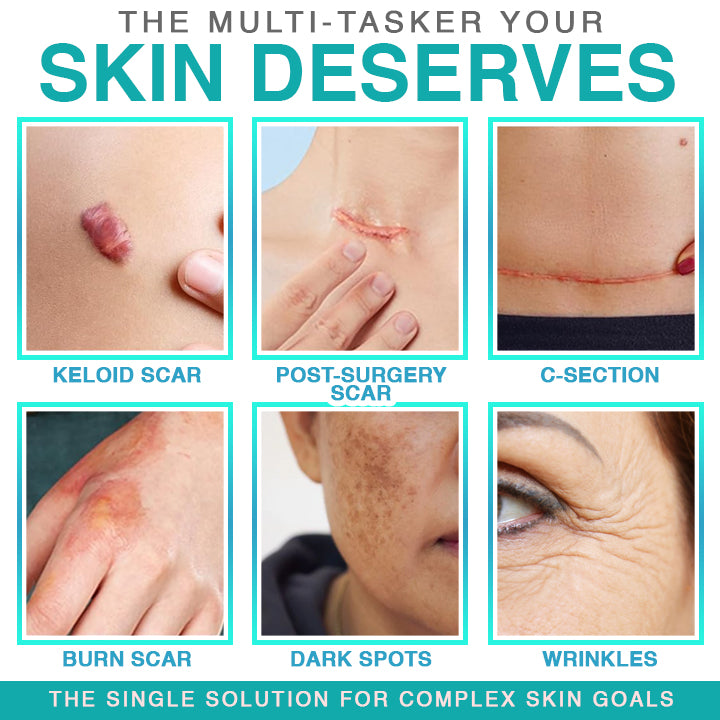 VERVEBEAD™ 3-in-1 Silicone Scar Sheets - A926