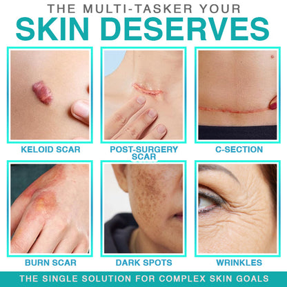 VERVEBEAD™ 3-in-1 Silicone Scar Sheets - A926