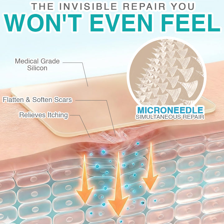 VERVEBEAD™ 3-in-1 Silicone Scar Sheets - A926
