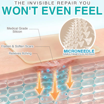 VERVEBEAD™ 3-in-1 Silicone Scar Sheets - A926